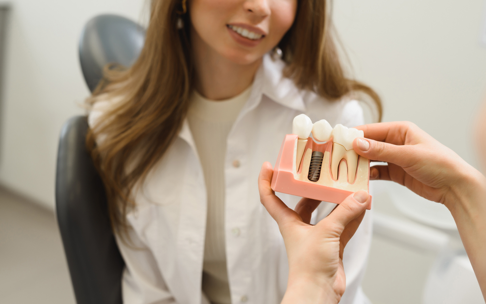 Zubné implantáty: aké prinášajú výhody?